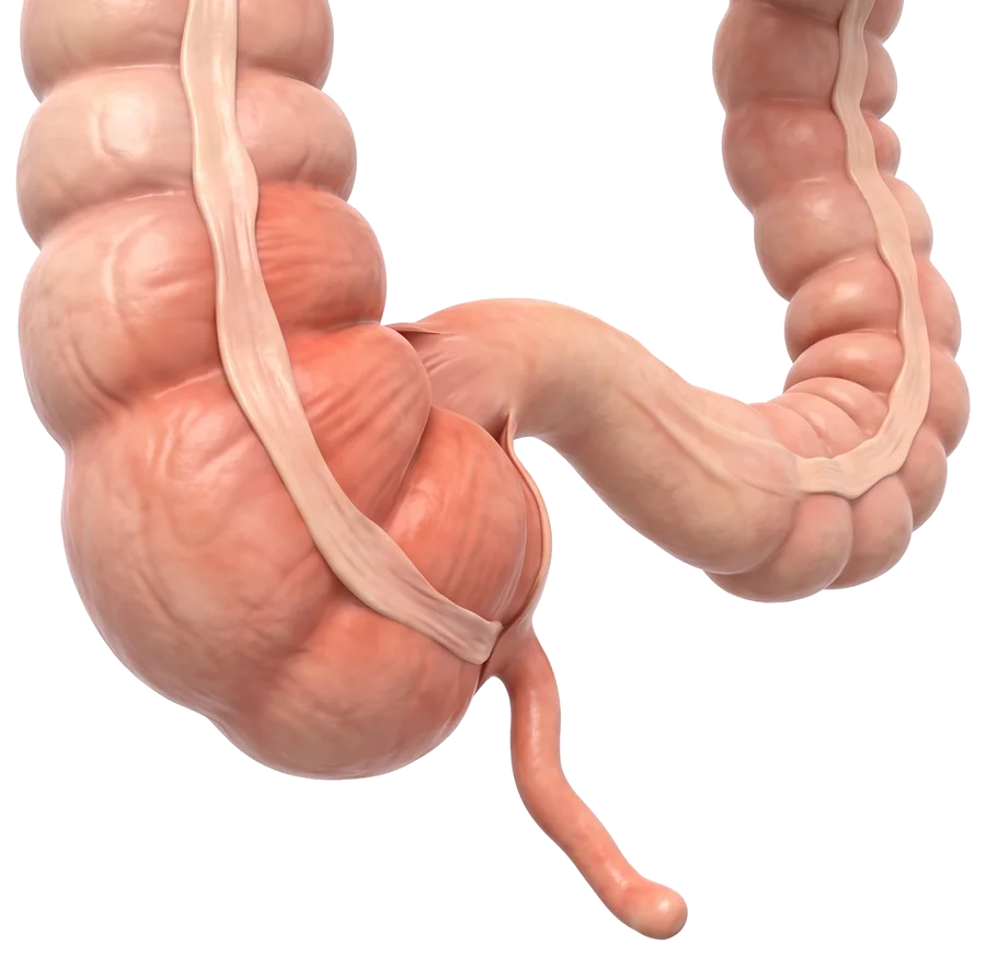 Diagrama anatómico del apéndice y el ciego, en la parte baja derecha del abdomen
