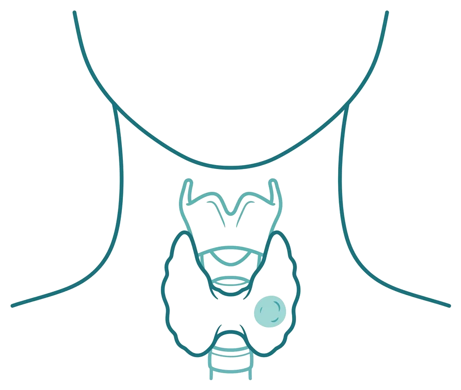 Diagrama anatómico de la glándula tiroides en el cuello