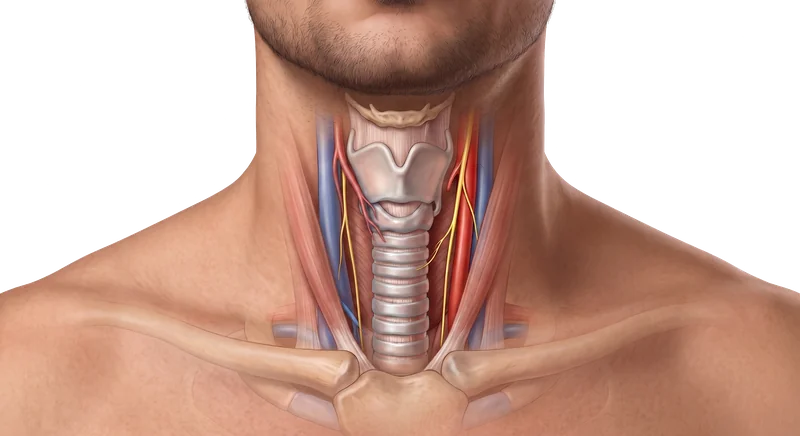 Diagrama del cuello mostrando una tiroidectomía total: ambos lóbulos tiroideos ya extirpados